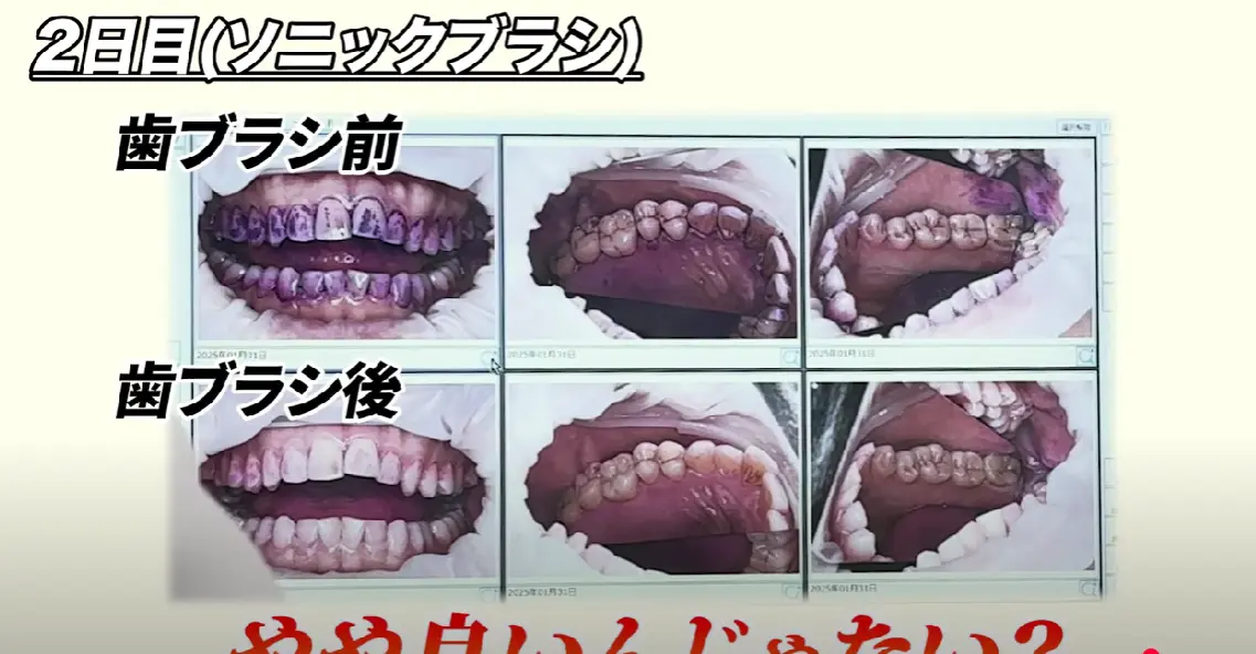 Sonic Brush V5 口コミレビュー2画像